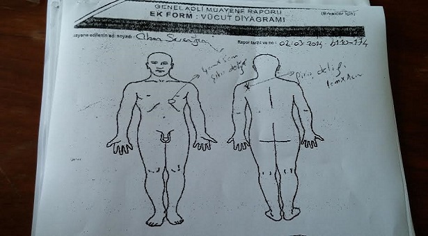 Yine kışla, yine şüpheli ölüm: Er Sevengin’in otopsi raporunda G-3 tüfeğinin mekaniği tersine çevrilmiş!