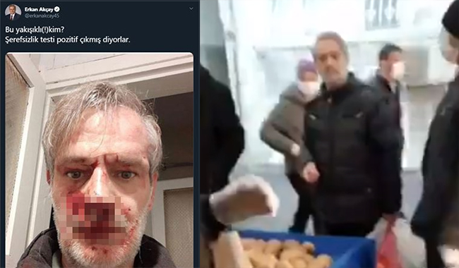 Ülkücüler saldırdı, MHP&#8217;li vekiller övgüyle paylaştı