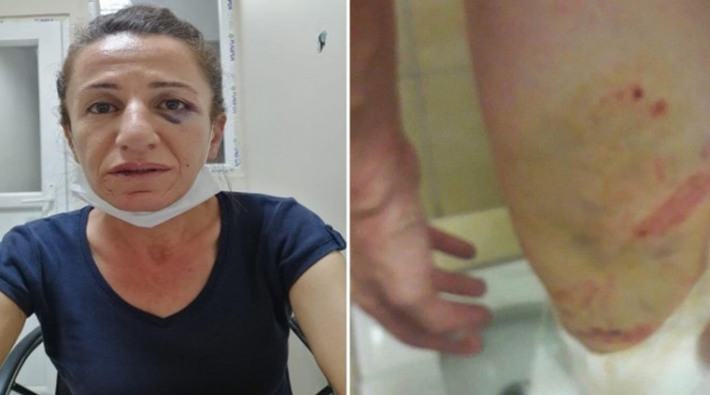 Evi basılan Rojbin Çetin&#8217;e gözaltında işkence