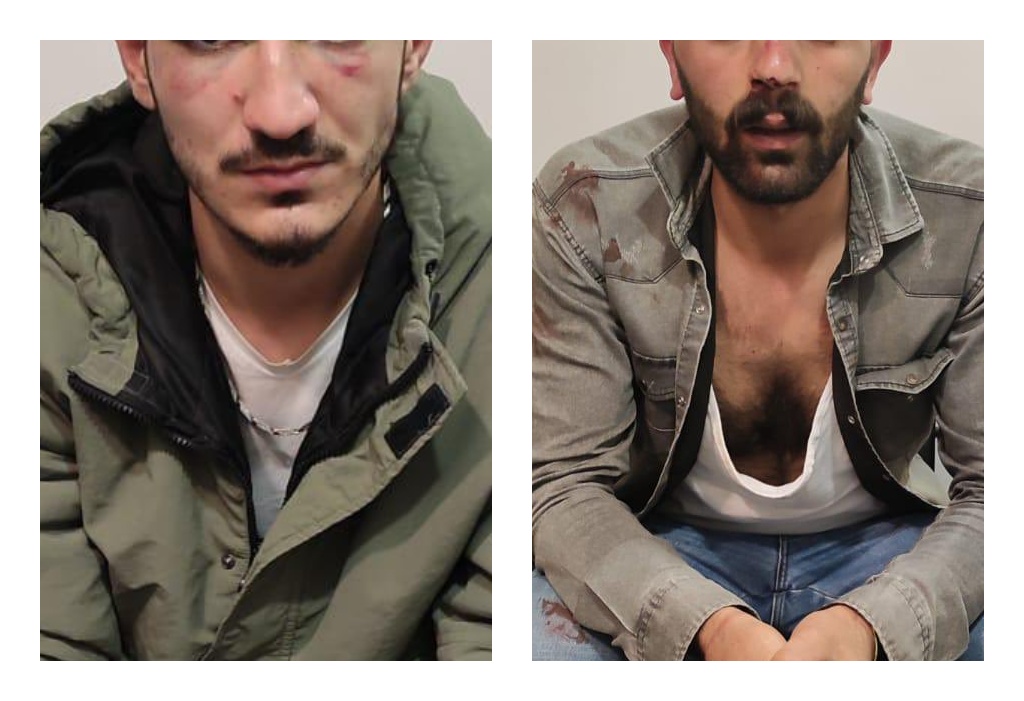 Sokak müzisyeni Cihan Aymaz&#8217;ın katledilmesine tepki gösteren iki kişi karakolda işkenceye uğradı