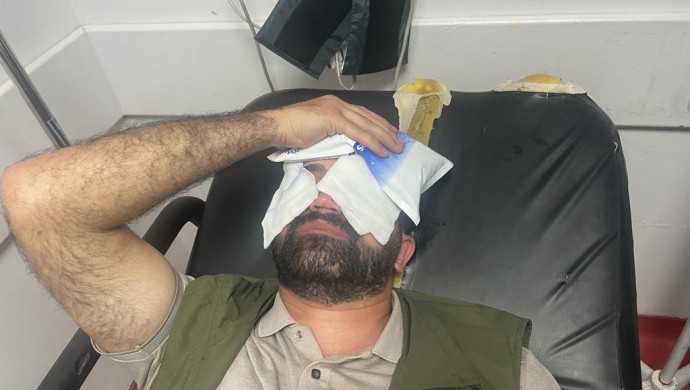 HDP il yöneticisine polis şiddeti: Darp edip ameliyatlı gözüne biber gazı sıktılar